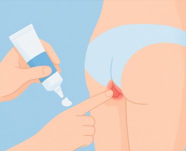 лечение геморроя